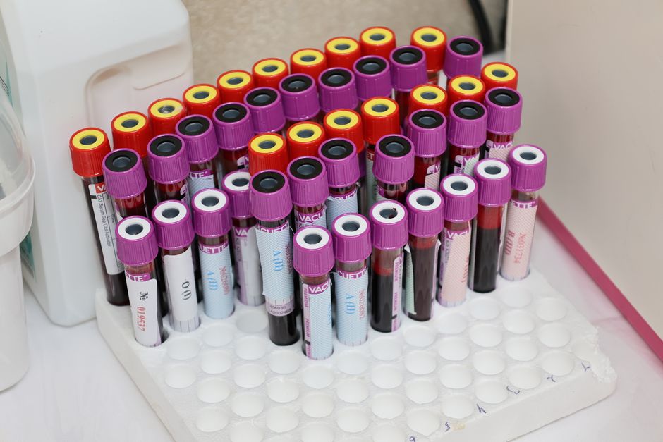 Blood sample vials arranged in a laboratory rack