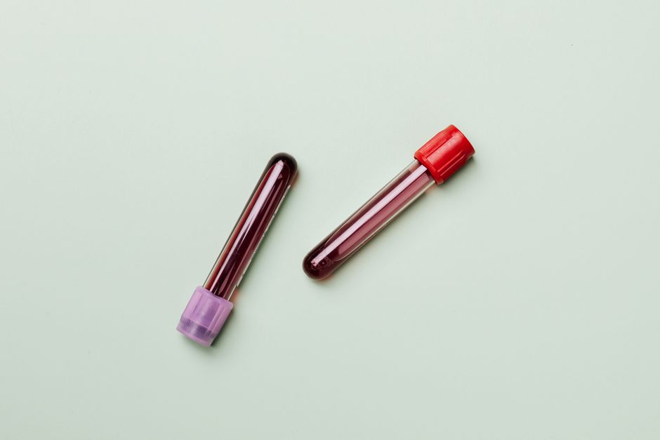 Blood samples in test tubes on a light background, ideal for medical and laboratory themes